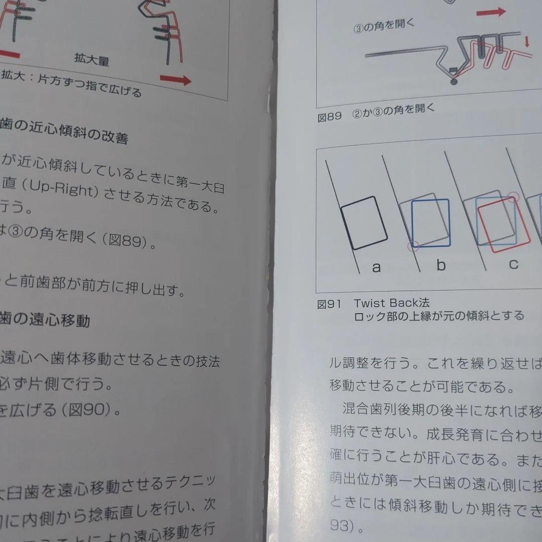 GPだからできる不正咬合予防のための診療