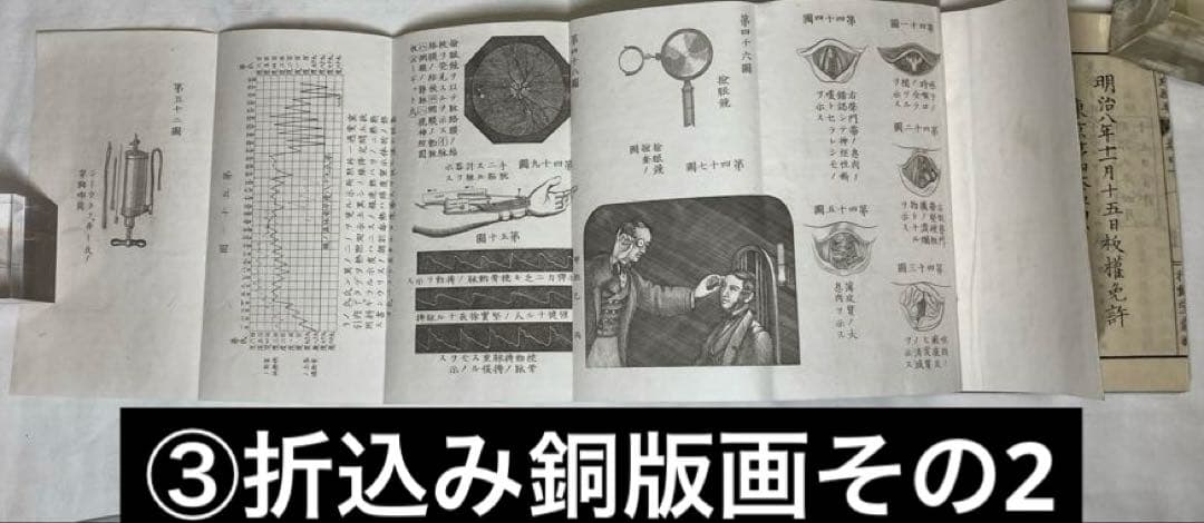 150年前・折込銅版図入・医学書【華氏病理摘要】5冊揃い完本