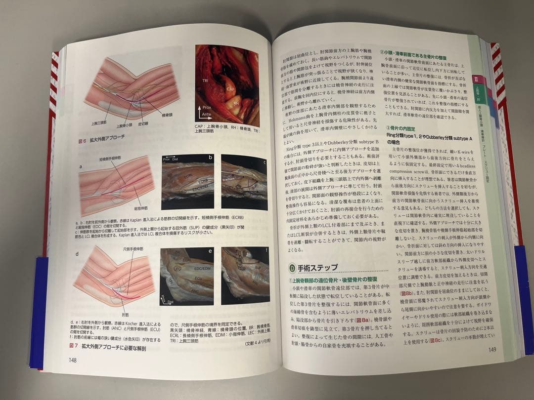スタンダード骨折手術治療 上肢