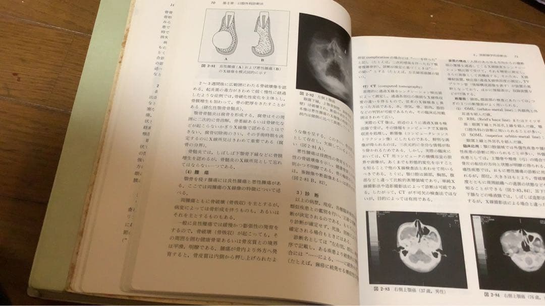 口腔外科学　第3版　医歯薬出版