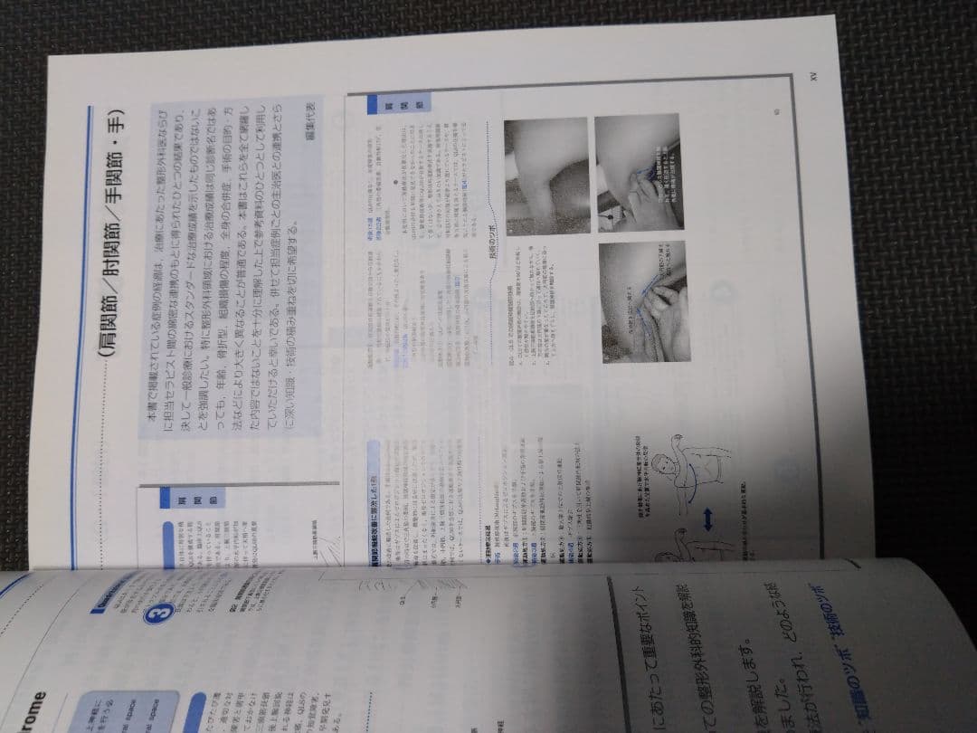 触診技術　整形外科運動療法ナビゲーション 上肢　理学療法士　作業療法士　国家試験