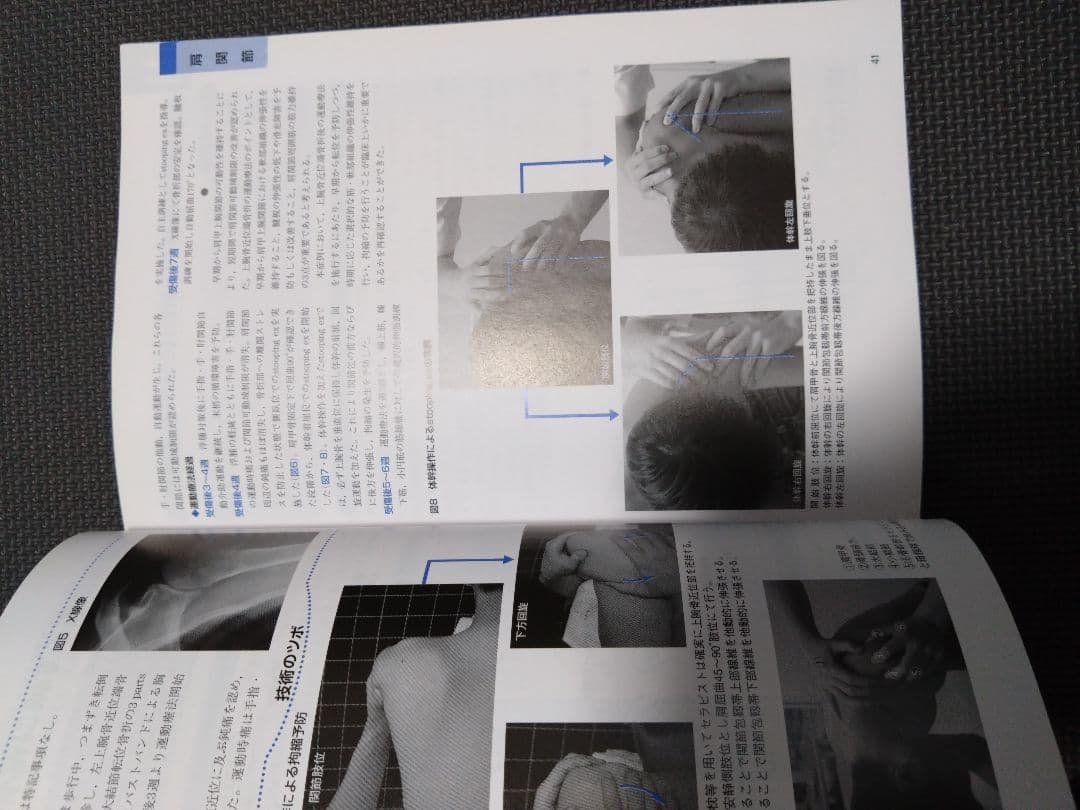 触診技術　整形外科運動療法ナビゲーション 上肢　理学療法士　作業療法士　国家試験
