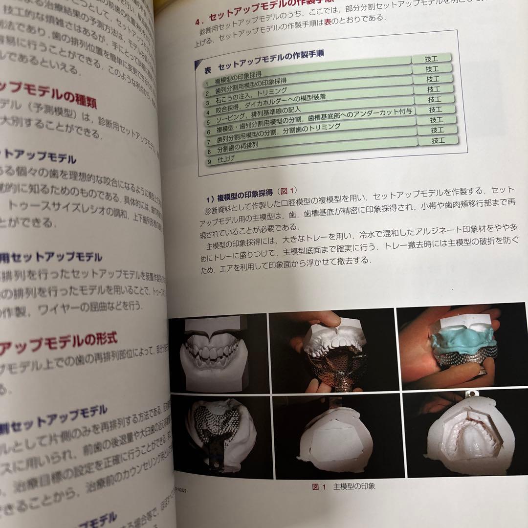 チェアサイド・ラボサイドの矯正装置ビジュアルガイド