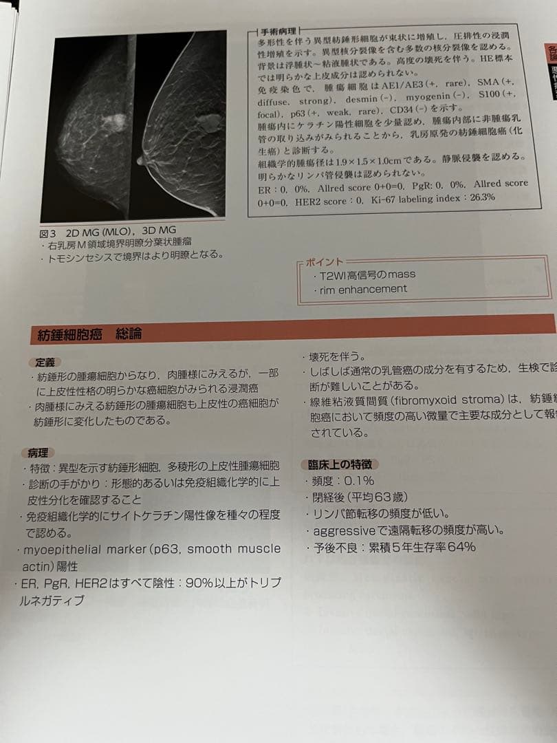 【裁断済】乳房MRIアトラス