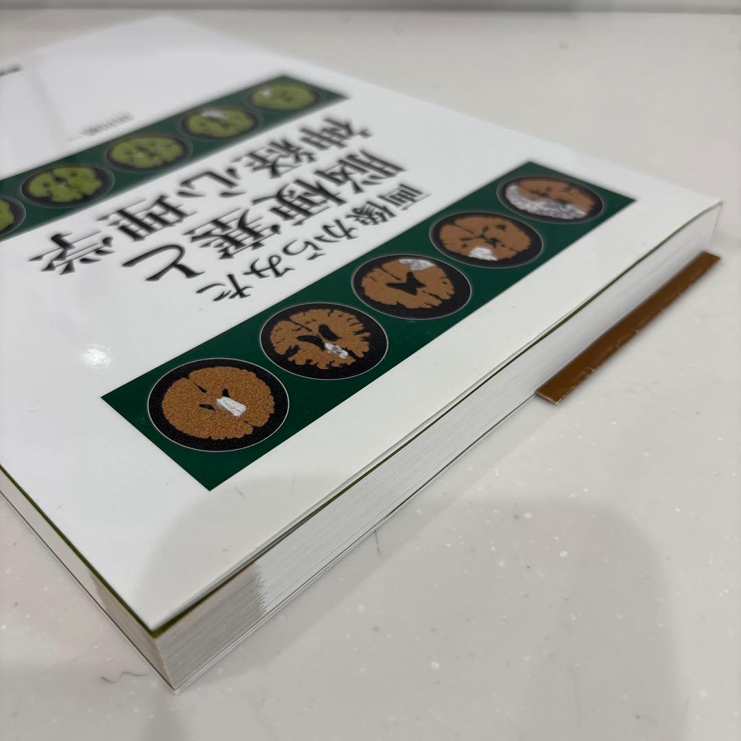 画像からみた脳梗塞と神経心理学