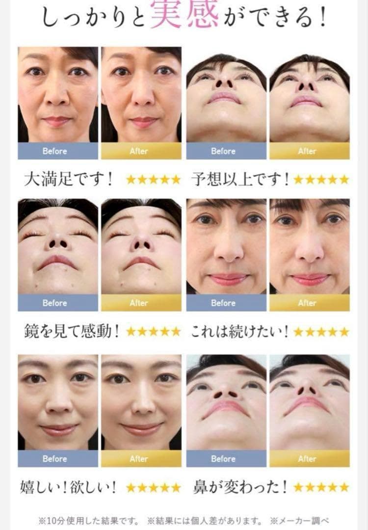 新品未開封ノーズクリップEMS ルクセアフォーネス luxcear fornez