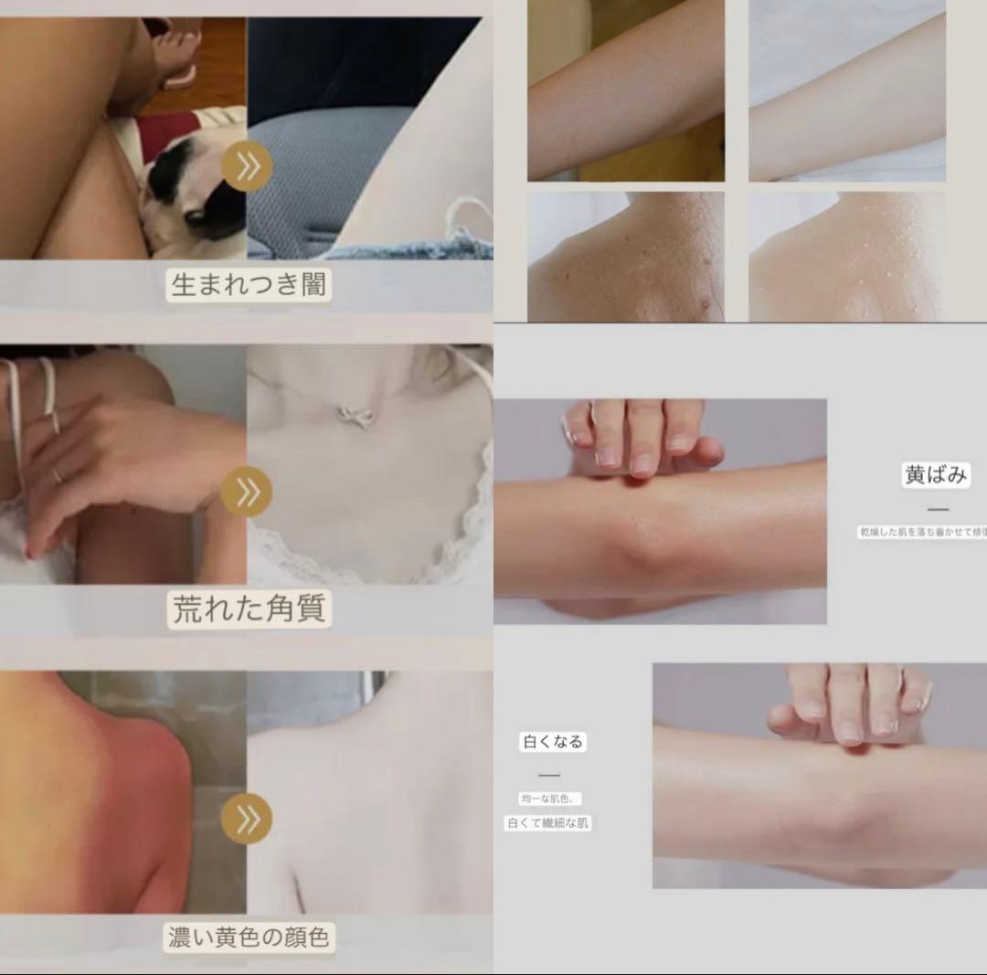 最先端✨全身美白クリーム　✨✨肌みせに自信がもてます❤️✨✨⭐️⭐️⭐️⭐️⭐️⭐️