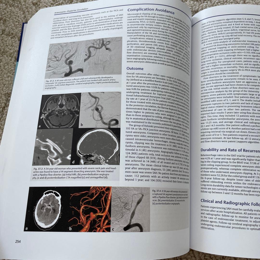 健康・医学 Decision Making in Neurovascular Disease