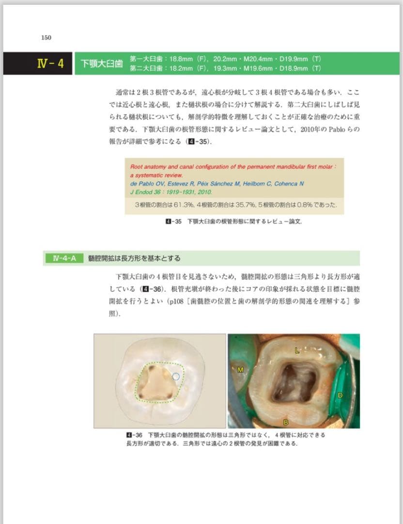 歯内療法 成功への道 臨床根管解剖: 基本的知識と歯種別の臨床ポイント