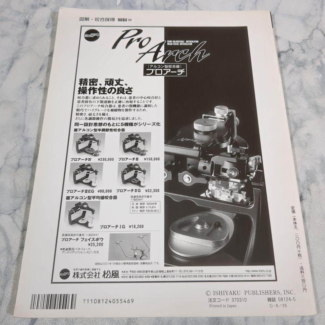 図解・咬合採得