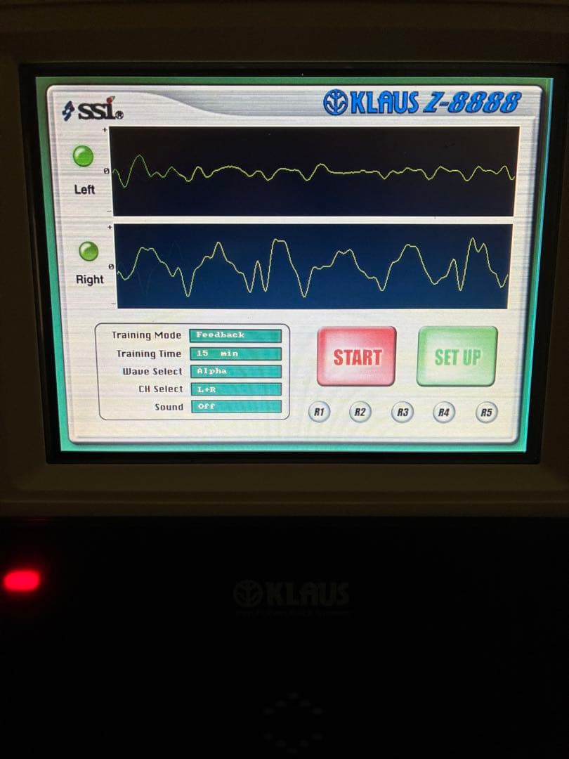 9割引。KLAUS Z8888 サイコフィードバックシステム アルファ波 SSI