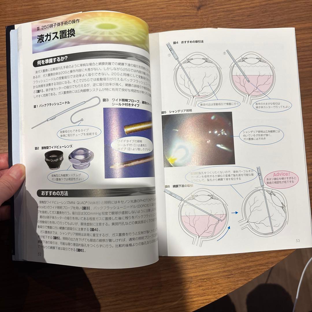 眼科　今日から実践！小切開硝子体手術