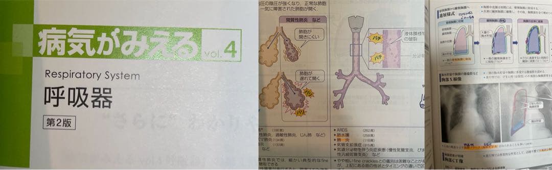【12冊セット】病気がみえるvol1-11＋公衆衛生がみえる